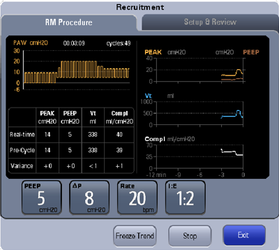 anesthesia machine