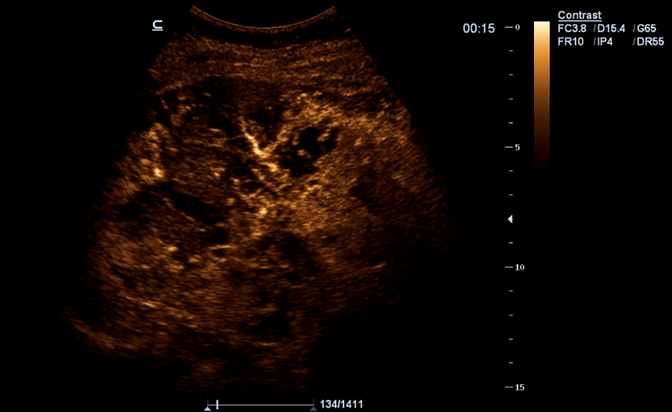 UWN (Ultra-Wideband Non-linear) Contrast Imaging