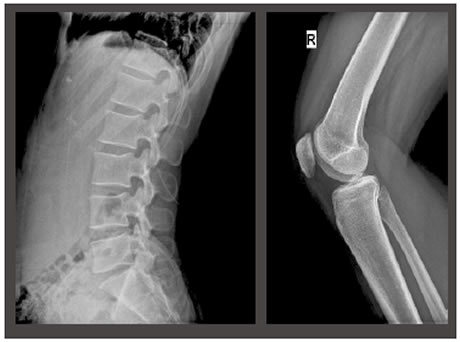 High Image Quality with Low X-ray Dose