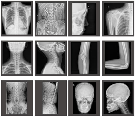 High Image Quality with Low X-ray Dose