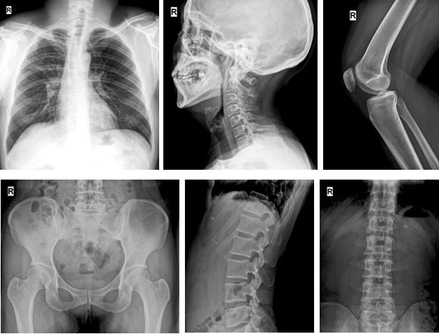 Proven Image Quality Guarantee Precise Diagnosis