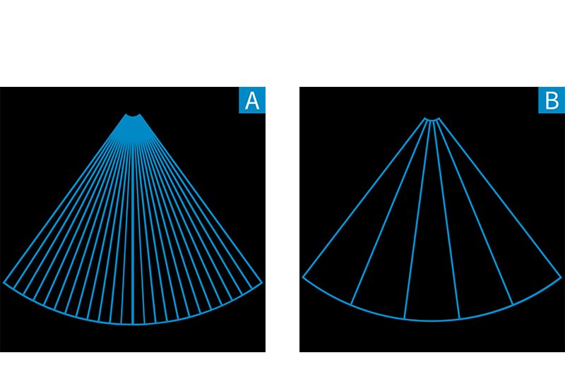 Zone Sonography Technology